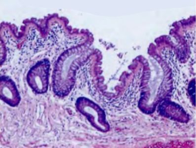 rectum-histology
