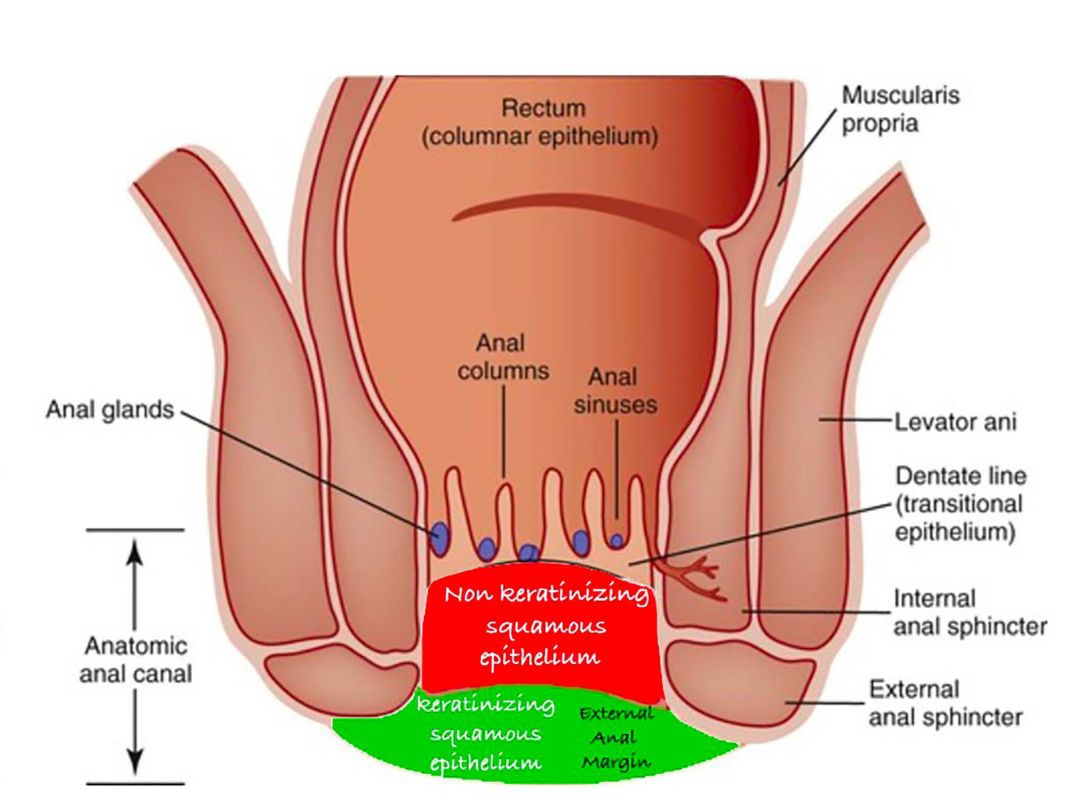 safety parameter for external anal margin