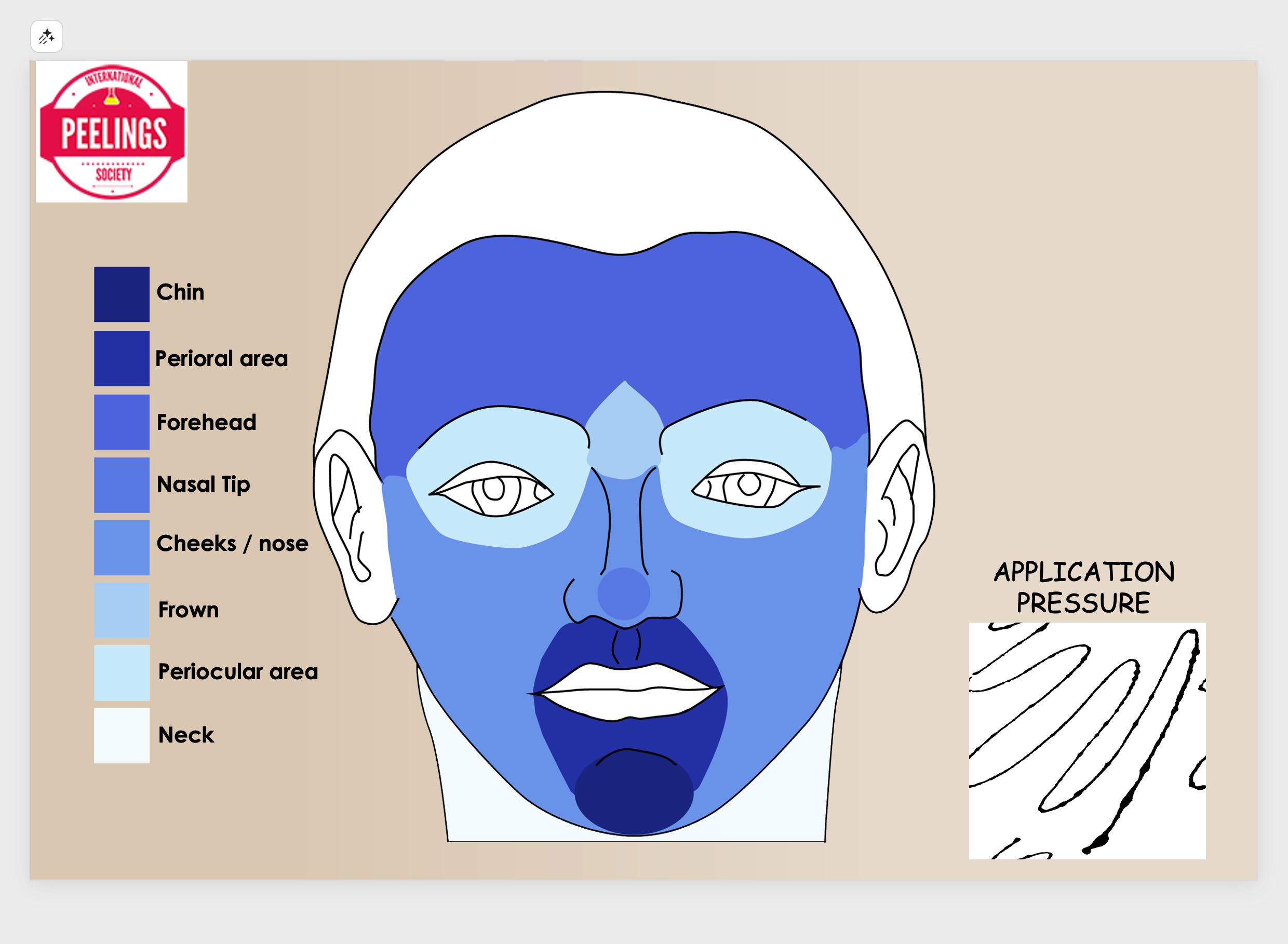 TCA application pressure and facial zones mapping for controlled chemical peeling
