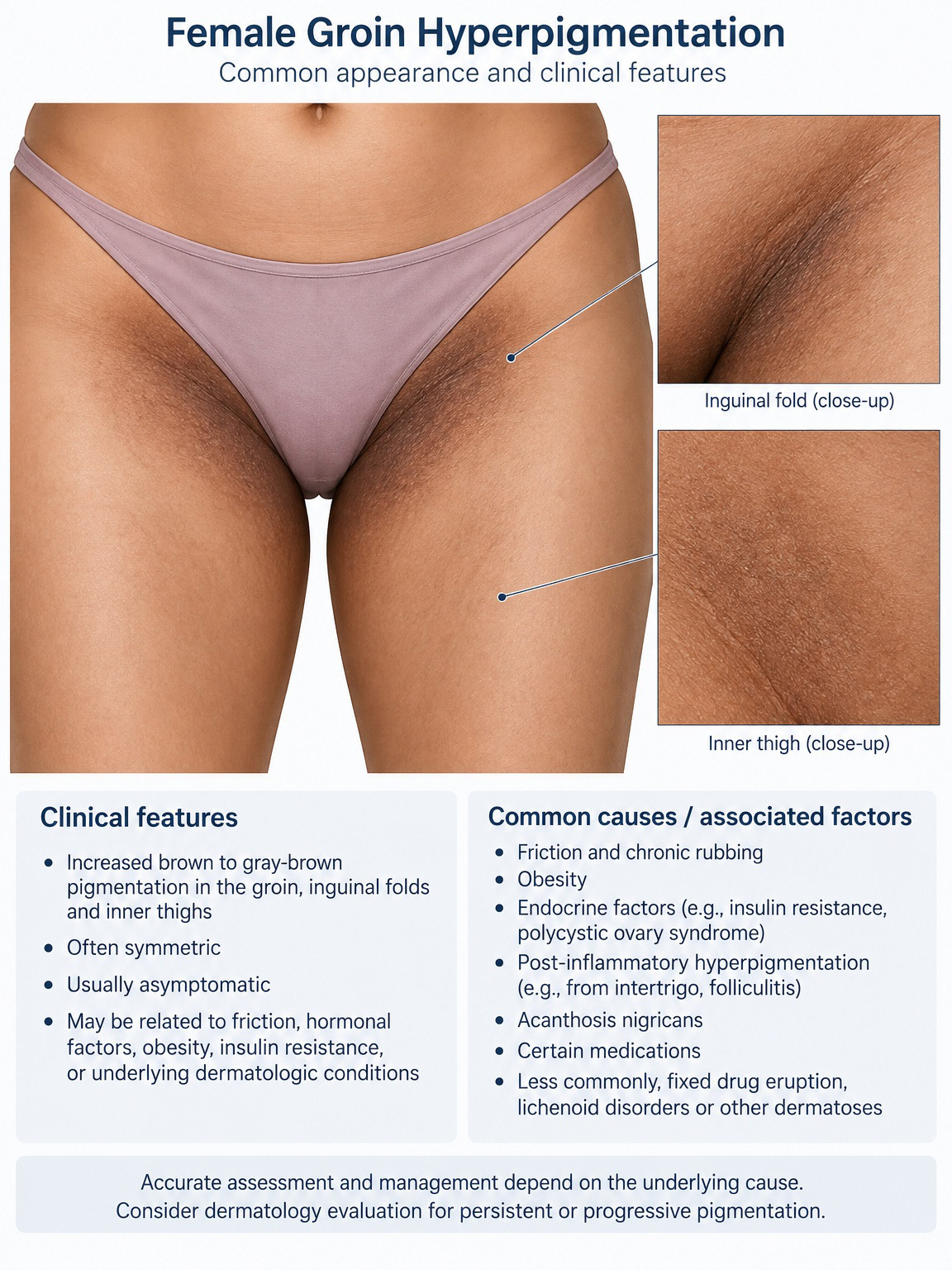 Medical illustration showing external anatomical areas that may present intimate hyperpigmentation