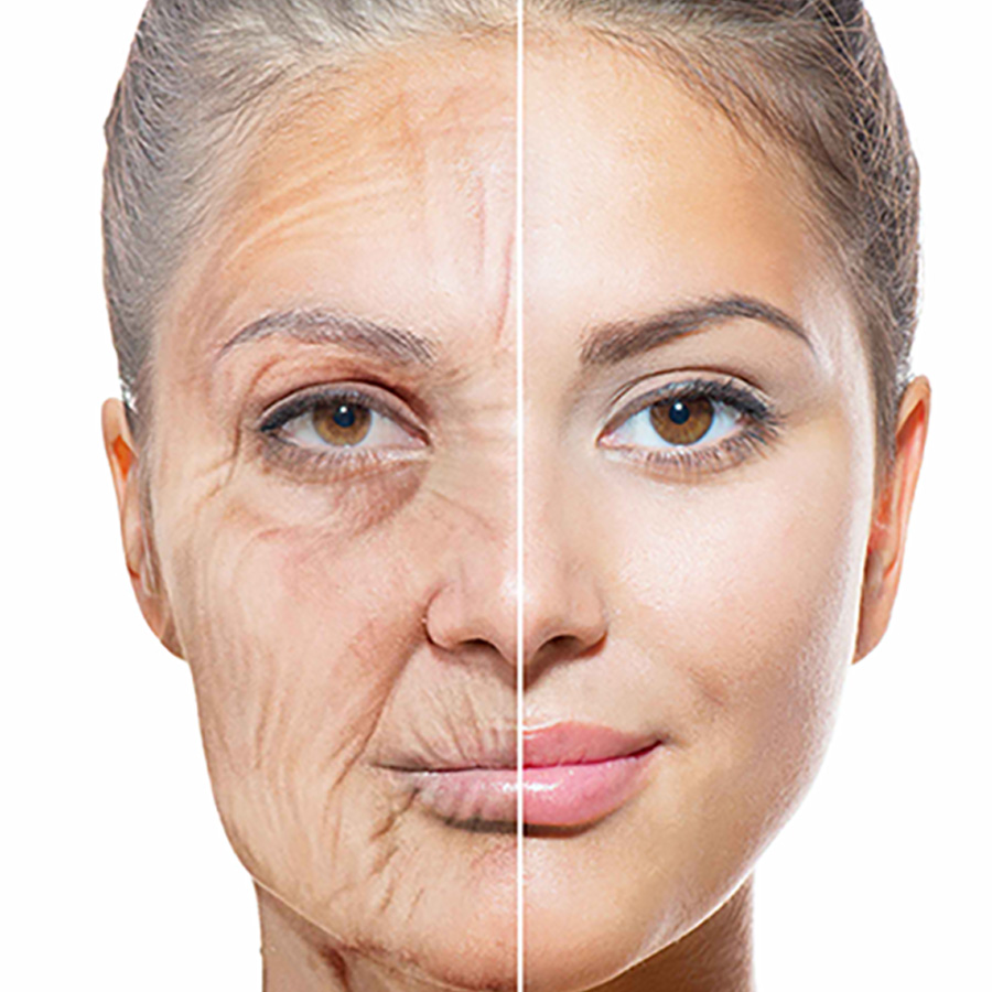 intrinsic skin aging and facial skin laxity