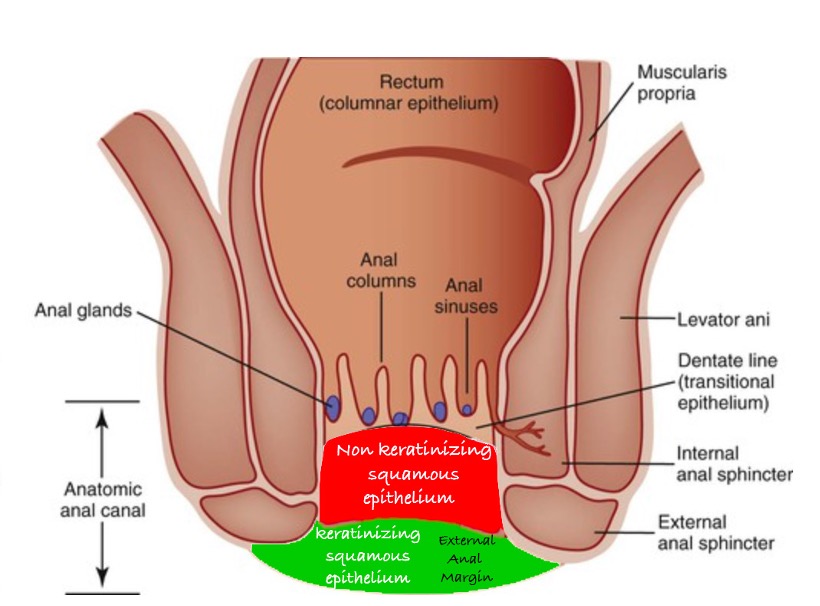 Anatomical diagram showing external anal margin, keratinized external squamous epithelium, transitional anal epithelium and rectal structures
