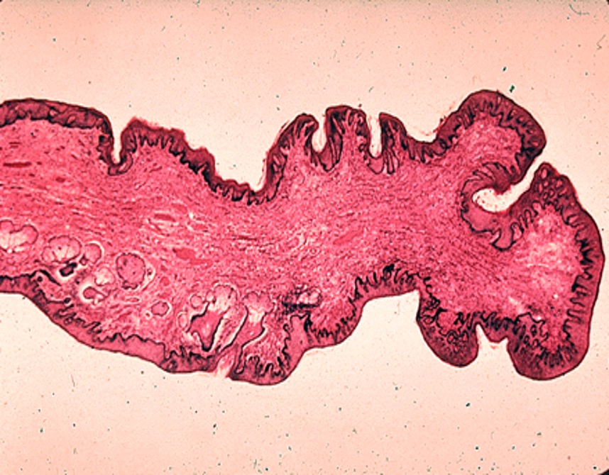 Histological appearance of labia minora tissue