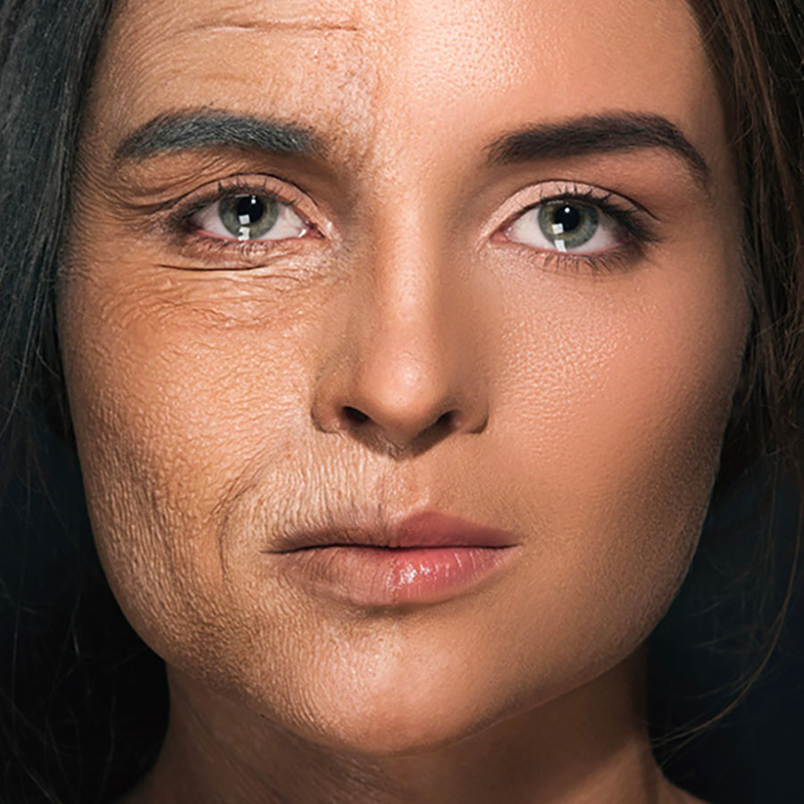 facial wrinkles and fine lines associated with skin aging