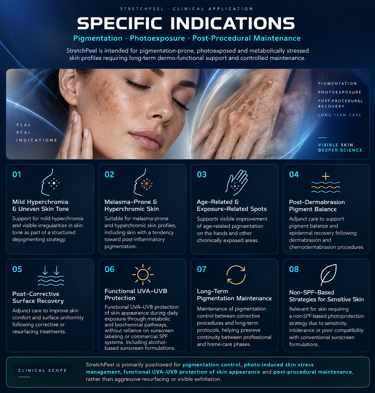 StretchPeel specific indications for pigmentation, photoexposure and post-procedural maintenance