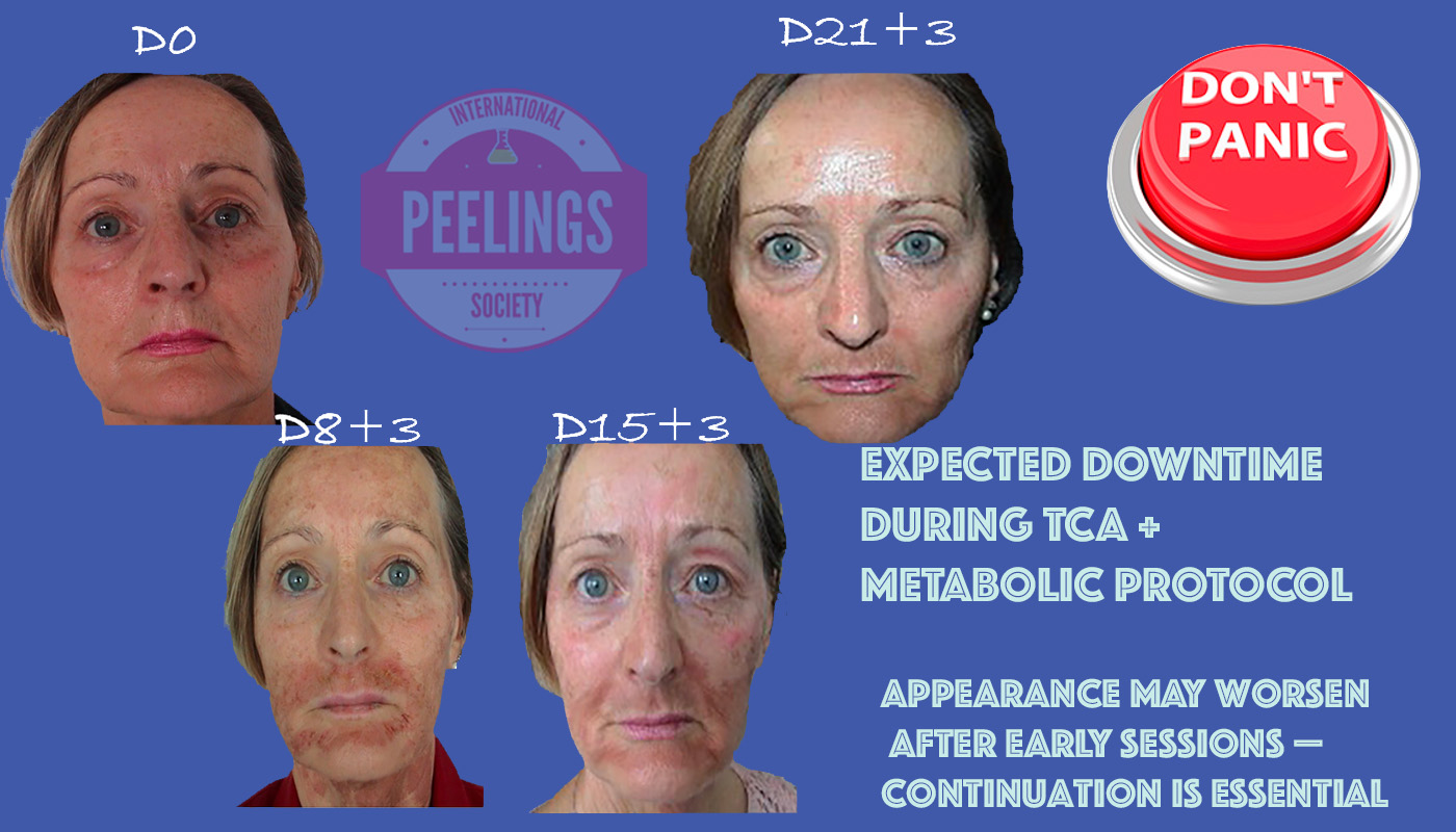 Downtime information and controlled recovery timeline