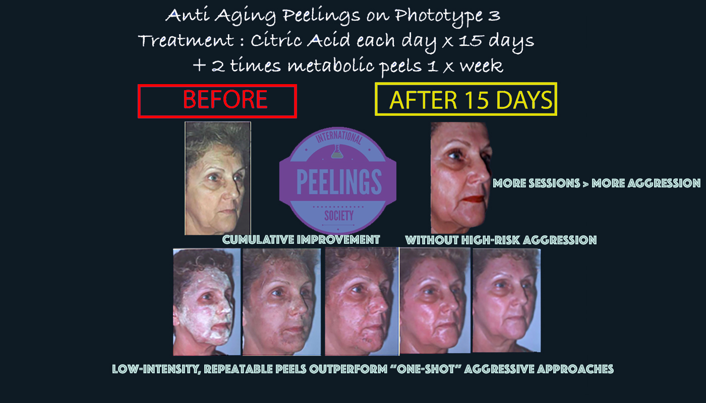 More sessions better than aggression: repeatable low-intensity protocol