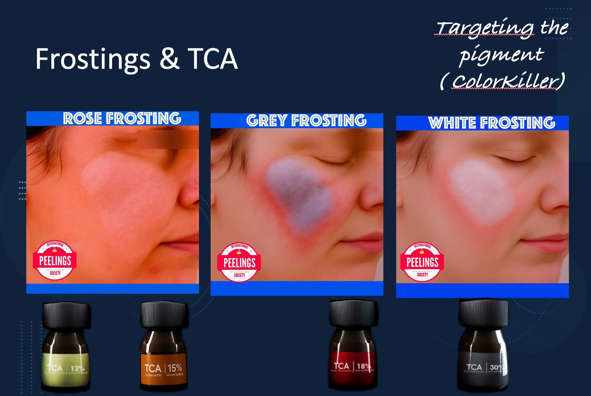 frosting and tca