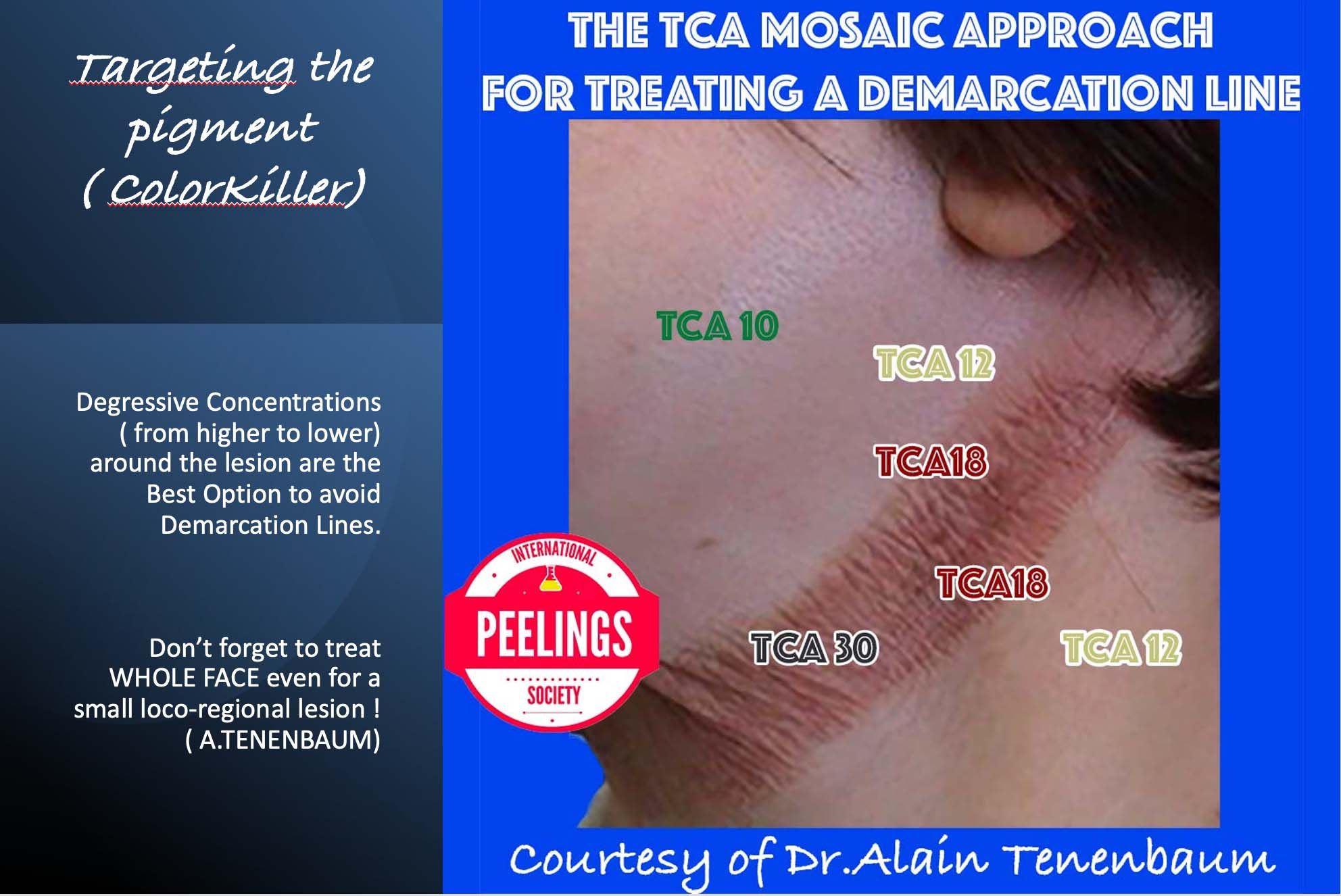 TCA mosaic for Demarcation Line